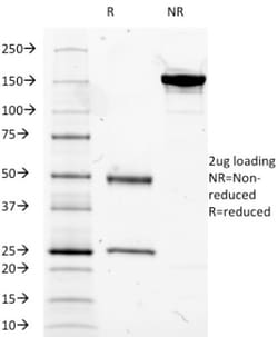 MUC5AC Antibody (2-11M1), Novus Biologicals 0.2mg; Unlabeled:Antibodies,